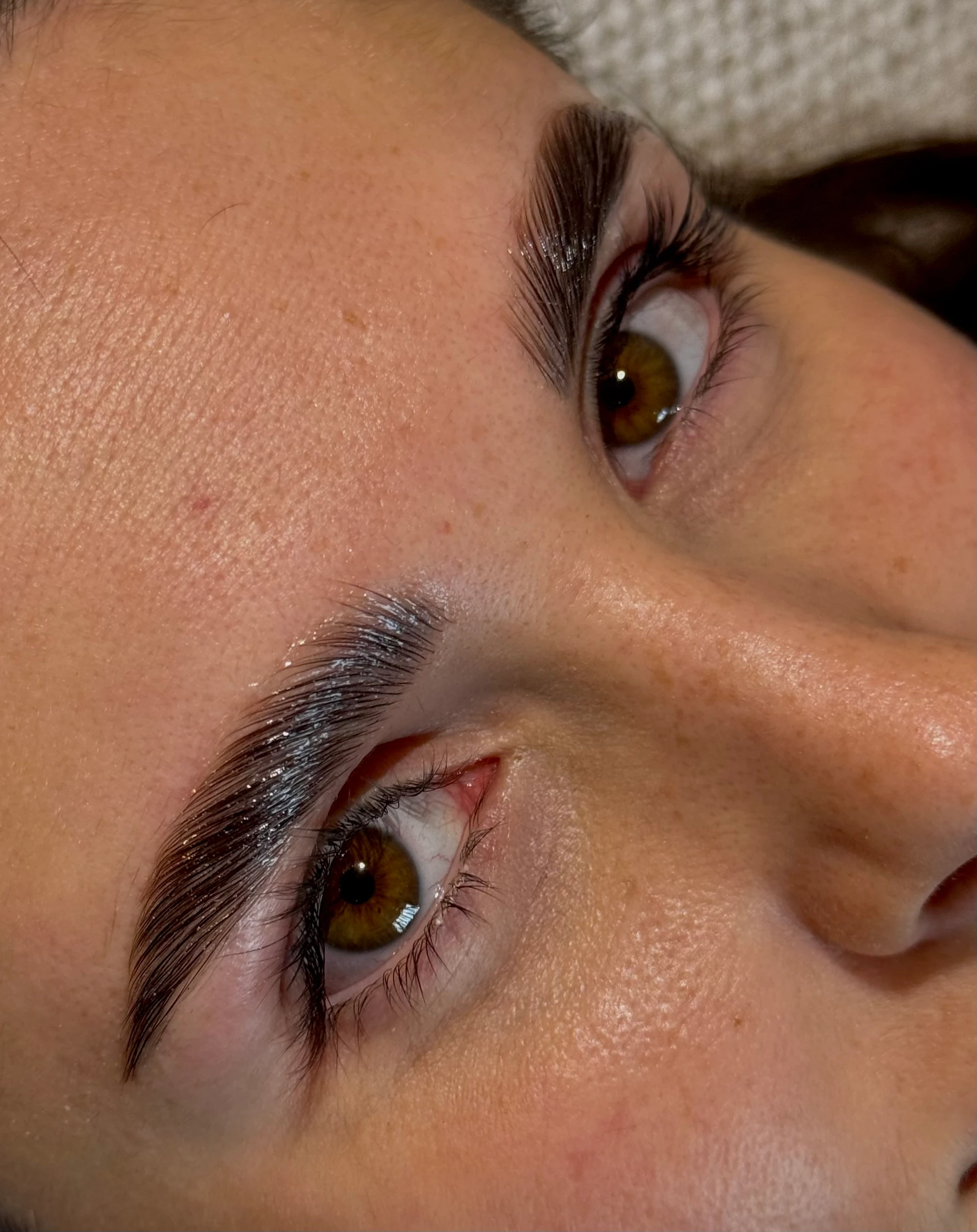 BROWLIFT LUCIA BROWLIFT LUCIA