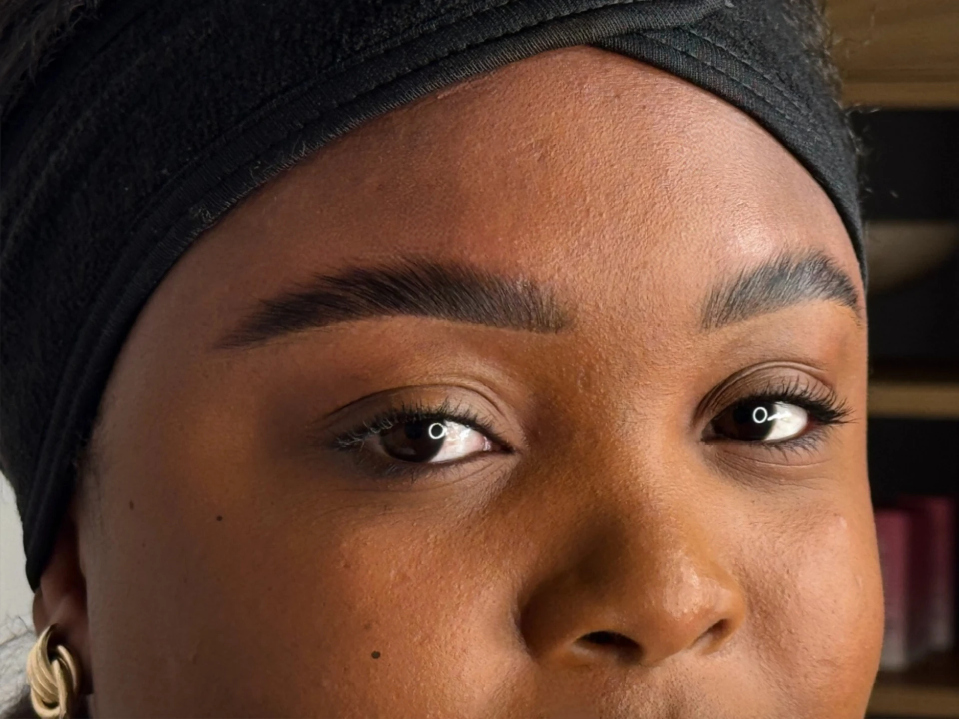 BROWLIFT PANGRACE BROWLIFT PANGRACE